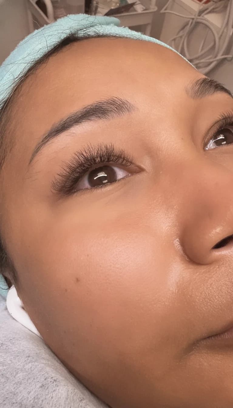 A recent glowing skin result at Sofipie Studio