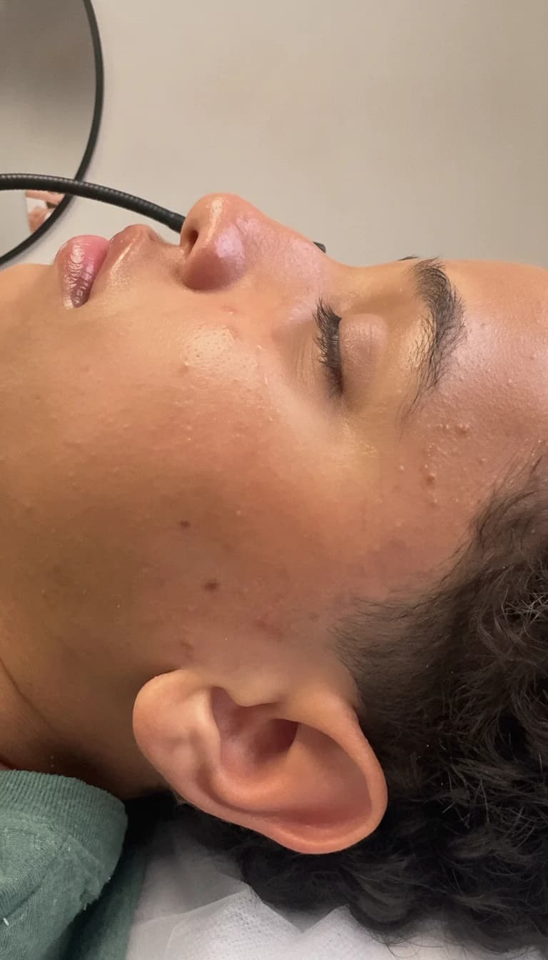 Dermaplaning in Saugus, MA